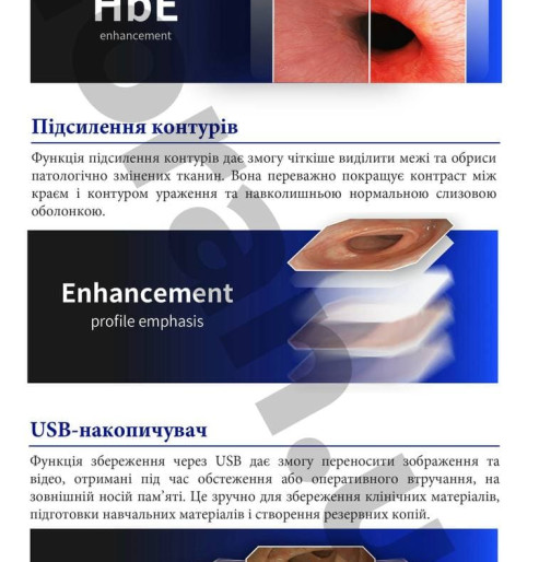 Ендоскопічна стійка для гастроскопії та колоноскопії
